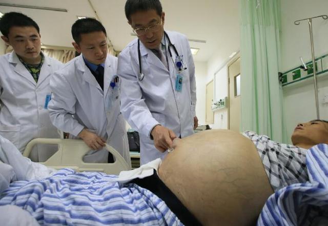 有腹水怎么办，肝衰竭肚子里面有腹水怎么办（肚子里的腹水该如何消掉）