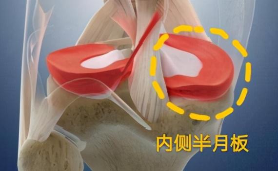 膝关节图片结构图，膝关节细节解剖图（不同位置的膝盖疼）