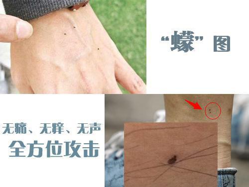 一种跟芝麻似的硬壳虫子，一种跟芝麻似的硬壳虫子 会装死（蠓虫一点也不“萌”）