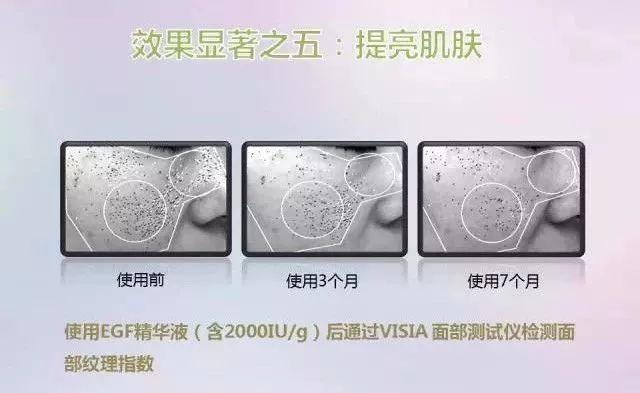 冻干粉用在护肤的哪个步骤，冻干粉免洗面膜效果怎么样（冻干粉是什么，有什么作用）