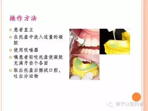 氟对牙齿的作用，含氟牙膏对牙齿的作用（有牙就要开始涂氟）