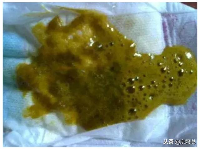 一个月的宝宝拉绿色大便什么原因，满月婴儿大便呈绿色是怎么回事（宝宝拉绿便的6个常见原因）