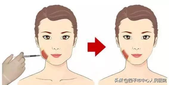 来大姨妈可以打瘦脸针吗，来大姨妈可以打瘦脸针吗女生（打瘦脸针前后注意事项）