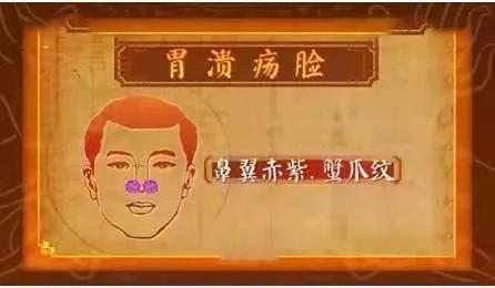 耳珠是哪个部位，耳朵长痣的位置图解（身体好不好，看“脸”就知道）