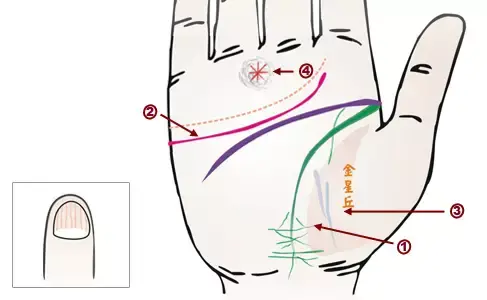 掌纹诊病实用图谱，看看你的掌纹：预示者不同疾病（可以诊断肝癌、糖尿病、高血压、妇科病、脑溢血）