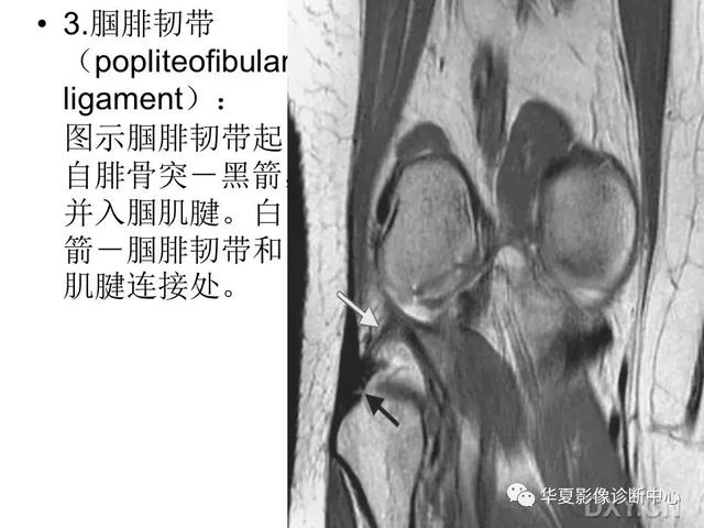 膝关节解剖结构图，膝盖解剖图示意图（膝关节MRI之正常解剖综述）