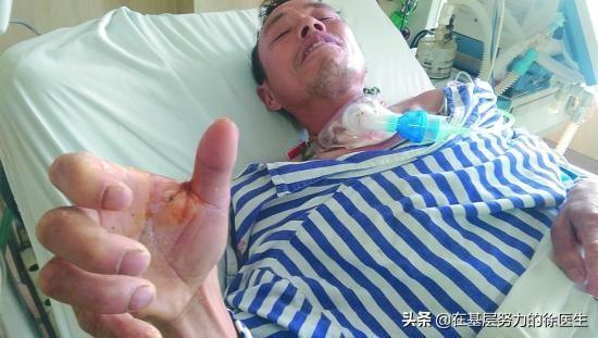 破伤风初期症状是什么致死率多少，正确认识破伤风