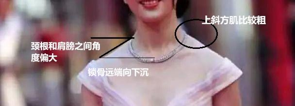 溜肩怎么练成平肩，男生溜肩怎么练成平肩（上斜方肌受着不可承受之重。选对方法）