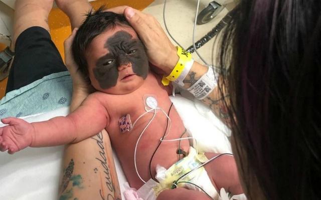 光敏印章怎么加油，原子公章和光敏章的区别（萌娃因“蝙蝠侠”胎记遭网暴）