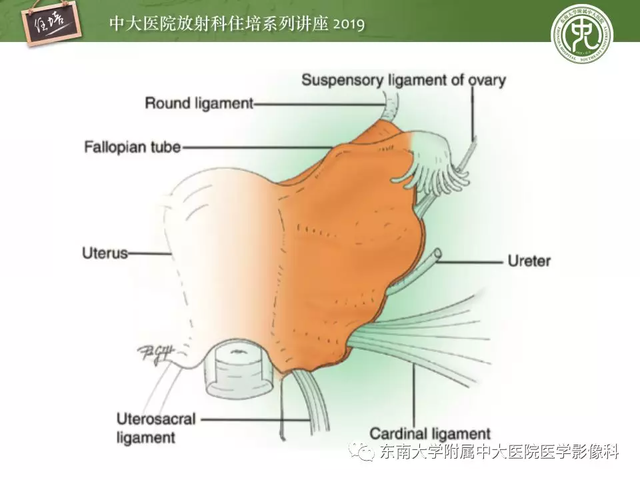 子宫颈影像解剖，子宫详细解剖及磁共振信号分析