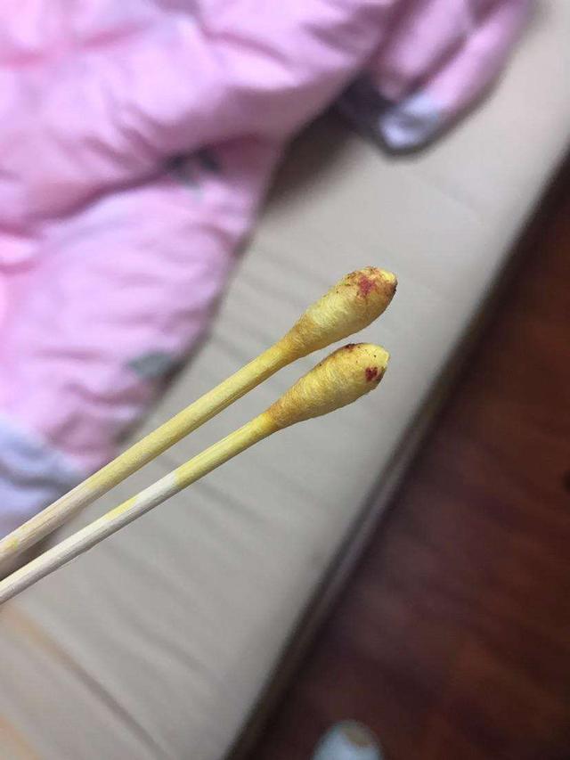 酒精是酸性还是碱性，酒精属于酸性还是碱性（为啥要用75%乙醇消毒剂）