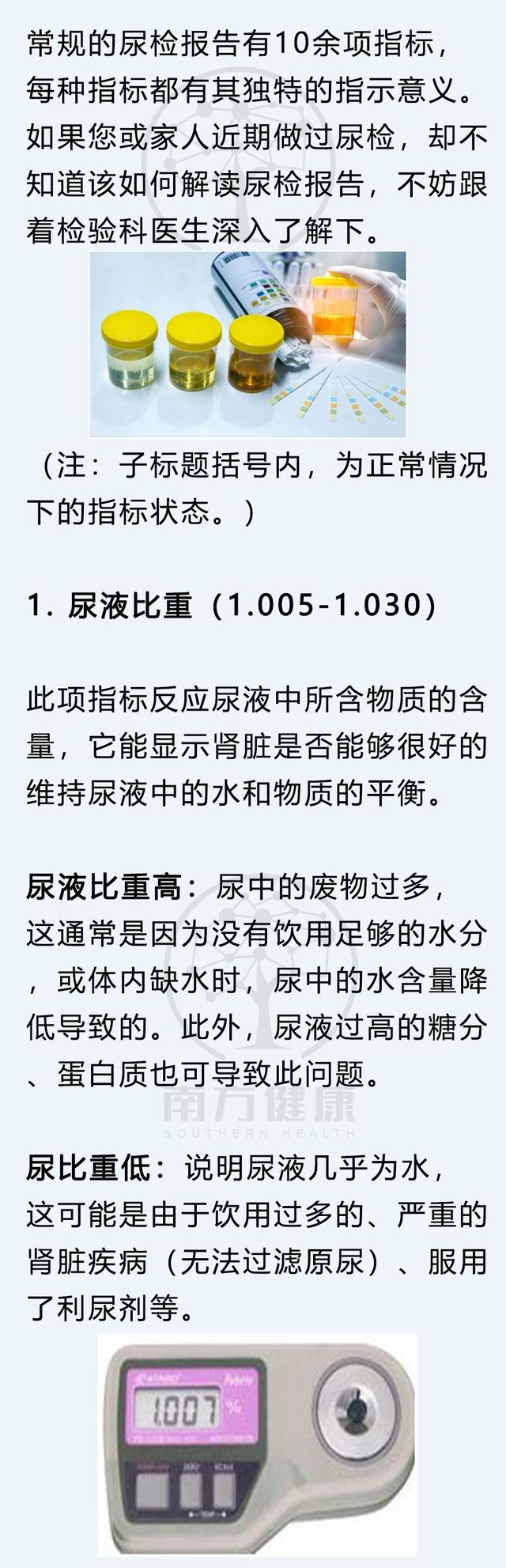 尿常规怎么检查，男性尿常规怎么看（5分钟判断身体健康）