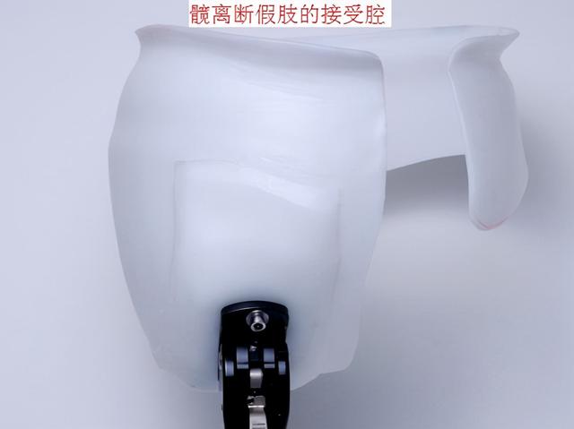 义肢和假肢有哪些不同，假腿为什么叫义肢（下肢截肢的类型及适用的假肢）