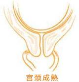 孕妇宫颈的长度是多少正常，孕期正常子宫颈的长度是多少（能否顺产要看宫颈成熟度）