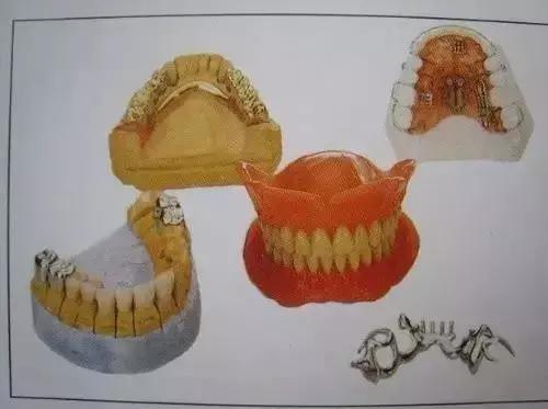 烤瓷牙是怎么做的，烤瓷牙是怎么做的伤牙吗（牙医教你如何选择烤瓷牙的材料）