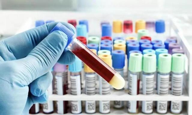 胰脏是什么，胰脏是什么番（还有4类主要原因）