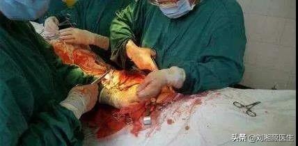 刺梨是凉性还是热性，刺梨是凉性吗（——凝血检查及易栓症）