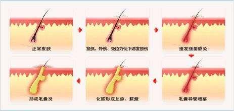 女生腋窝有毛还是没有毛好，女生有腋毛是好还是没有好（女人有毛性感还是无毛性感）