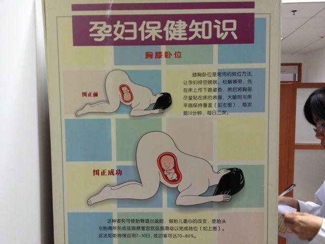 宝宝入盆后的肚型图片，宝宝入盆后的肚型图片左枕前（5感觉+3变化说明胎儿已入盆）