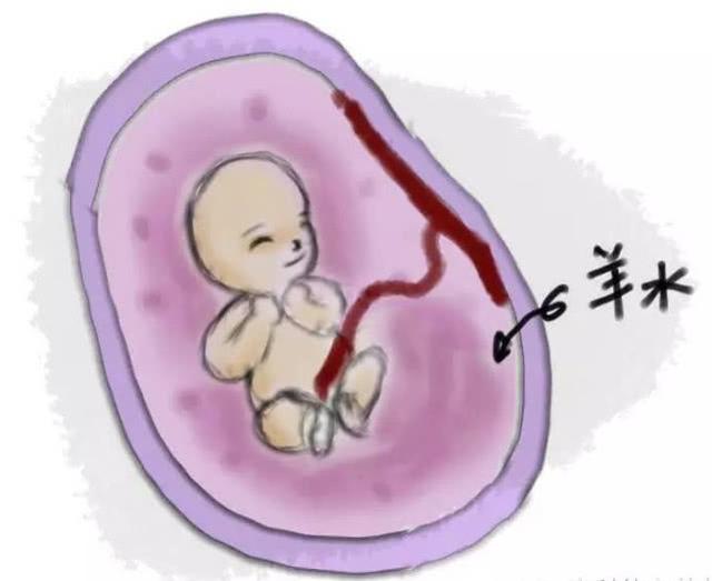 羊水是什么颜色，从羊水颜色等4个方面带你了解它（ph试纸羊水是什么颜色）