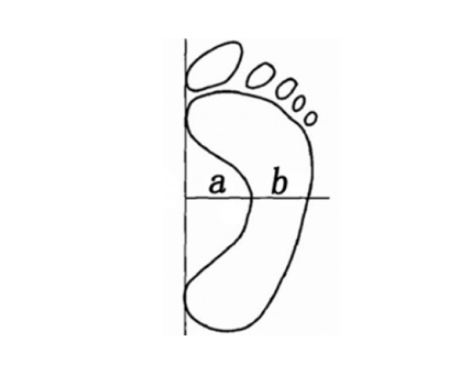 没有脚后跟的人穿鞋穿不住怎么办，没有脚后跟的人怎么穿高跟鞋（扁平足影响日常生活）