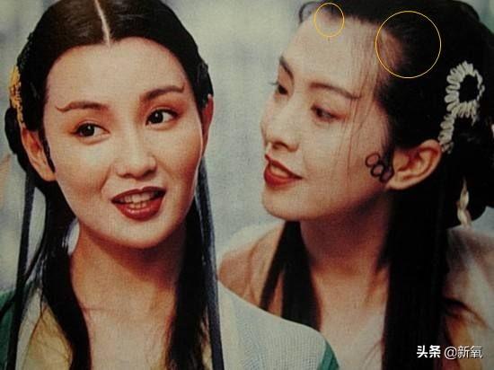 发际线粉会堵塞毛孔吗，发际线粉的危害（关晓彤才23岁就秃了）