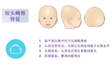 婴儿舟状头的图片，宝宝多大可以排除舟状头（婴幼儿头颅畸形）