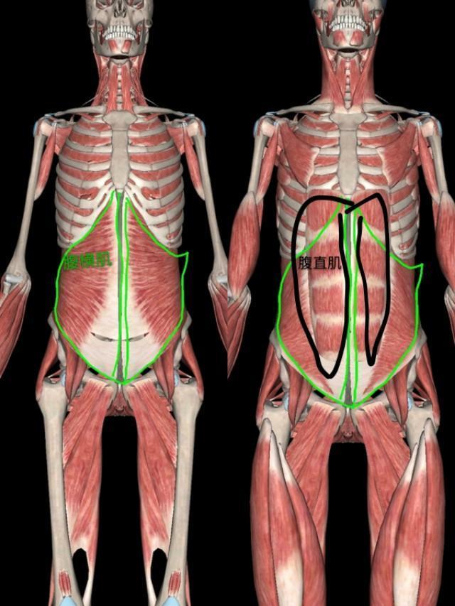 第一部分:認識腹直肌,腹橫肌和腹白線