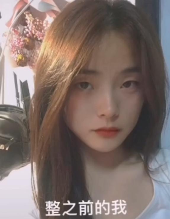 高级脸和网红脸区别，高级脸和网红脸区别在哪（女网红花6万整容成鞠婧祎）