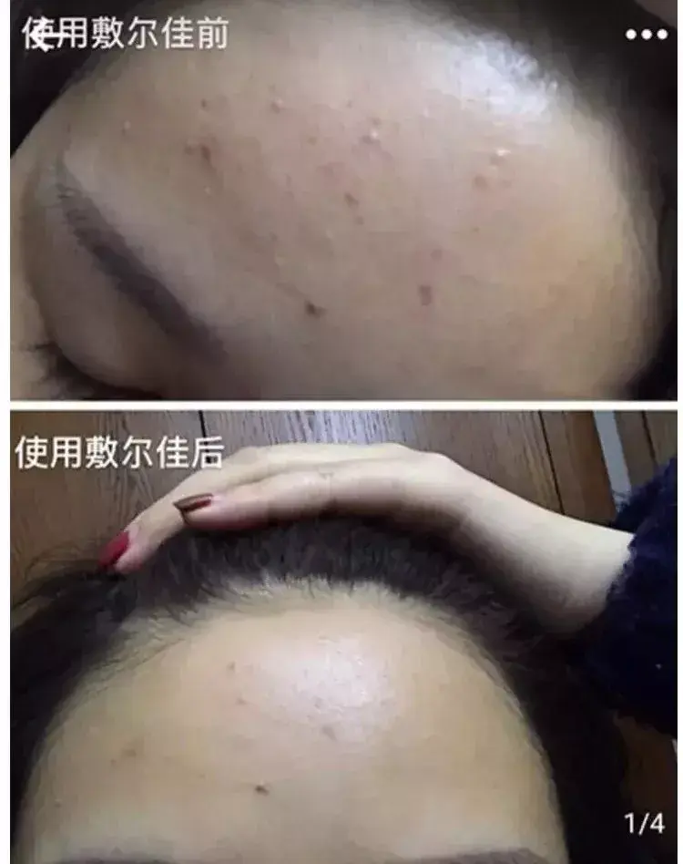 敷尔佳面膜(保湿面膜哪个牌子最好)