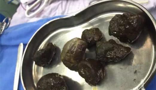 吃柿子能喝牛奶吗，吃柿子后多久能喝牛奶（柿子不能和牛奶一起吃）