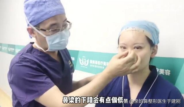一张图看懂鼻基底凹陷对比图，塌鼻秒变立体质感鼻