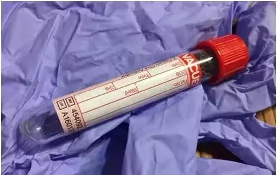 白细胞低到3.4严重吗，白细胞低到3.4严重吗?淋巴细胞百分比低,其他正常（血压、心率、C反应蛋白）