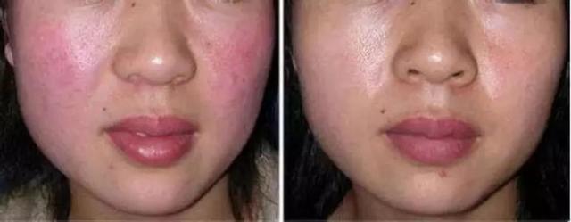 绿药膏的功效与作用，新绿药的作用和功效（修复皮肤破损的绿色之力）