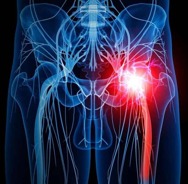 起始于腰部两个椎体之间的椎间孔神经根,向下依次到达于腰部,臀部