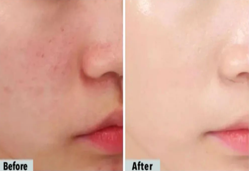 十滴水洗脸的用法，十滴水洗脸的用法与用量（还是十滴水比较方便）