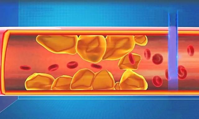 白细胞低到3.4严重吗，白细胞低到3.4严重吗?淋巴细胞百分比低,其他正常（血压、心率、C反应蛋白）