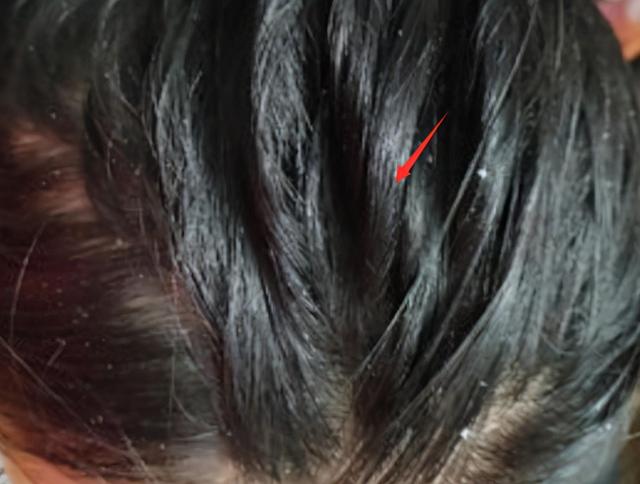 如何辨别自己的头发属于哪种发质，如何辨别自己的头发属于哪种发质呢（教你如何区分油性发质和干性发质）