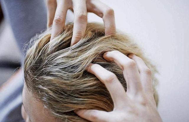 头发出油是什么原因导致的，头发出油是什么原因（这些原因不能忽视）