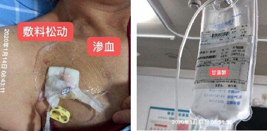 接口处充不进电弯着才充进电，充电 接口 插不进（输液港抽不出回血怎么办）