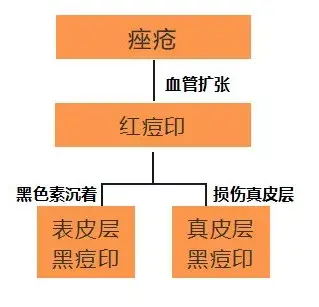 什么能祛痘和痘印，用什么可以祛痘祛痘印（红痘印黑痘印一年也去不掉）