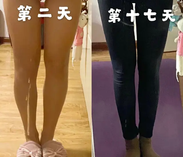 怎么快速瘦腿的方法组图，教你快速瘦腿的方法快速瘦腿（让你从“大象腿”变“漫画腿”）