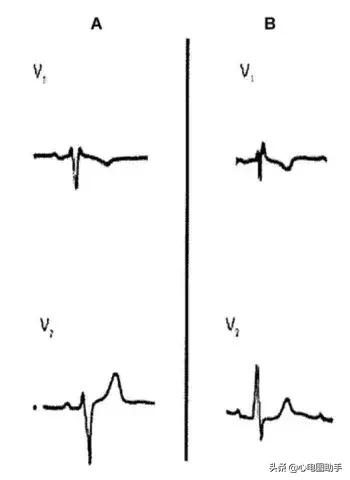 胸骨左缘第五肋间隙下两厘米的地方是她，我把她藏在心跳最剧烈的地方。，你是我放在胸骨左缘第五肋间隙的人（来看看这些需要注意的细节图片）