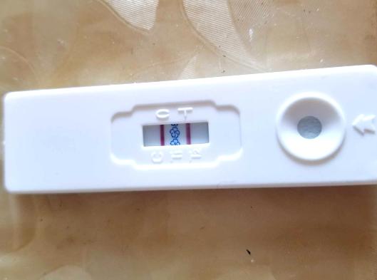 测试怀孕的方法，四个方法测怀孕准爆（看表现、用工具、做检查）