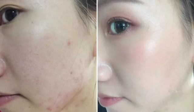 蜜粉刷和散粉刷的区别，蜜粉刷和散粉刷的区别是什么（都说“粉底刷”碾压“美妆蛋”）