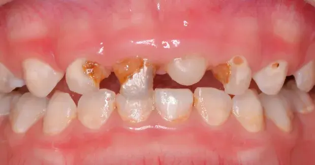 宝宝换奶瓶顺序，小宝宝奶瓶多久换一次（宝宝几岁用水杯）