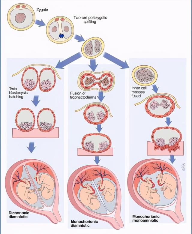 双胞胎一上一下好不好，双胞胎一上一下是龙凤（刷抖音刷到的双胞胎被DNA证实）