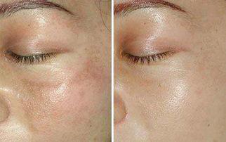 绿药膏的功效与作用，新绿药的作用和功效（修复皮肤破损的绿色之力）