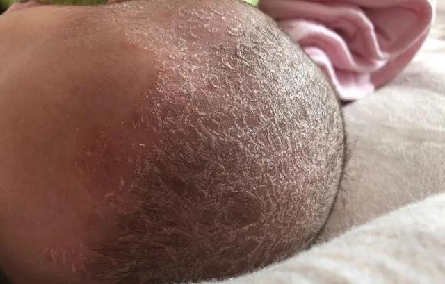 照顾新生儿有哪些禁忌，照顾新生儿有哪些禁忌症（这都是过来人“血的教训”）