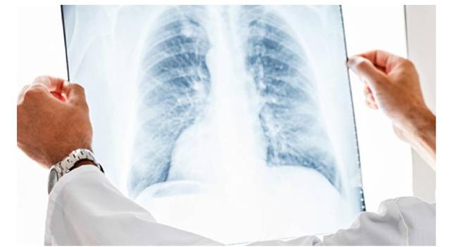 强生婴儿事件，强生美国召回3.3万瓶婴幼儿爽身粉